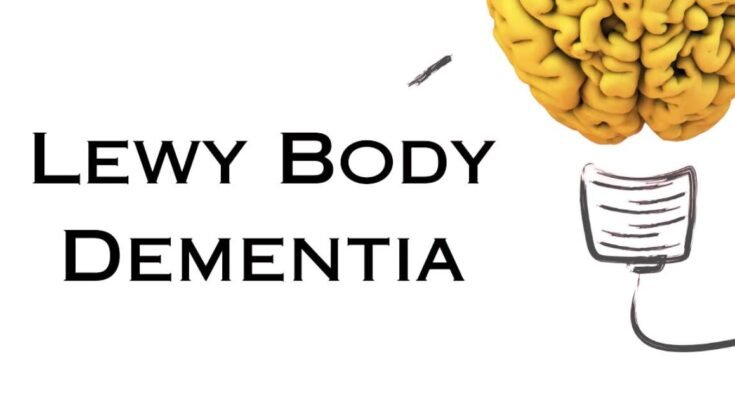 7 Stages Of Lewy Body Dementia A Comprehensive Guide