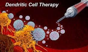 Dendritic Cell Therapy Practices in Germany: Future of Immunotherapy Dendritic Cell Therapy Practices